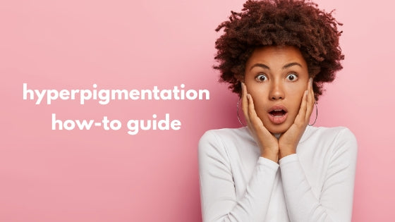 HOW TO TREAT HYPERPIGMENTATION: THE GLOW THEORY GUIDE